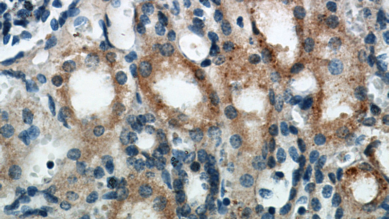 Immunohistochemical of paraffin-embedded human kidney using Catalog No:108370(BBS3 antibody) at dilution of 1:50 (under 40x lens)