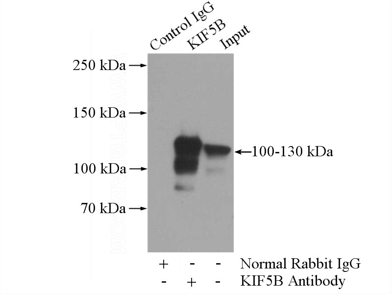 IP Result of anti-KIF5B (IP:Catalog No:112048, 5ug; Detection:Catalog No:112048 1:2000) with HepG2 cells lysate 3600ug.