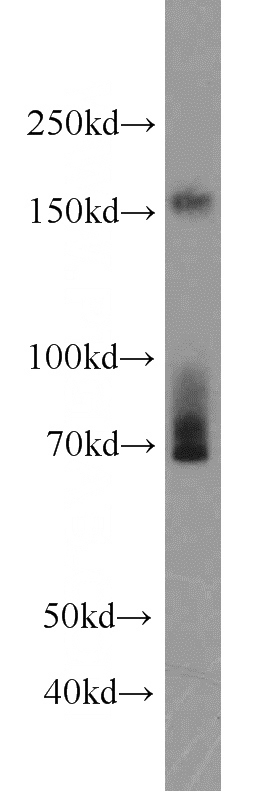Jurkat cells were subjected to SDS PAGE followed by western blot with Catalog No:110737(FNDC3B antibody) at dilution of 1:2000
