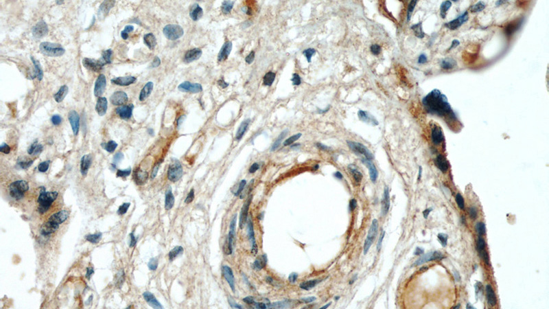 Immunohistochemical of paraffin-embedded human placenta using Catalog No:110248(ENG antibody) at dilution of 1:50 (under 40x lens)