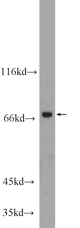 HeLa cells were subjected to SDS PAGE followed by western blot with Catalog No:112538(MGAT4A Antibody) at dilution of 1:1000