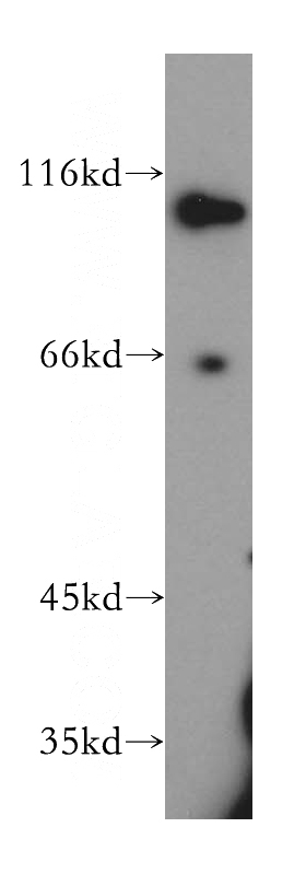 Jurkat cells were subjected to SDS PAGE followed by western blot with Catalog No:115478(SNX25 antibody) at dilution of 1:500