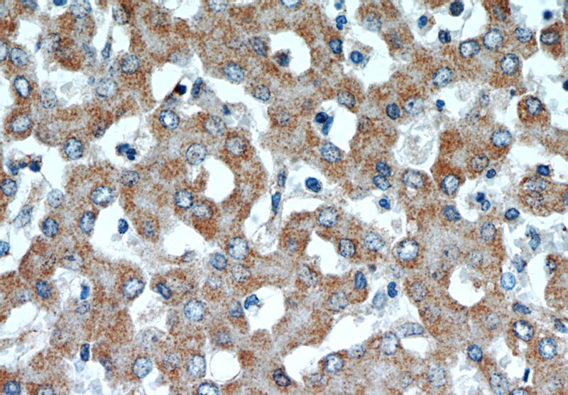Immunohistochemical of paraffin-embedded human liver using Catalog No:115631(ST7 antibody) at dilution of 1:50 (under 40x lens)