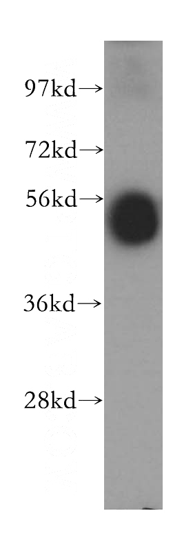 human spleen tissue were subjected to SDS PAGE followed by western blot with Catalog No:116482(TTRAP antibody) at dilution of 1:500