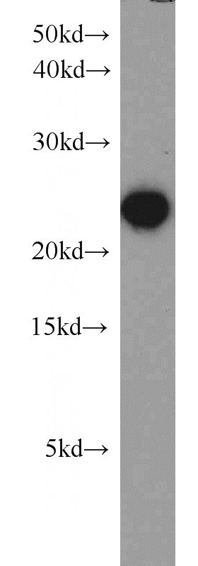 Jurkat cells were subjected to SDS PAGE followed by western blot with Catalog No:111191(GSTP1 antibody) at dilution of 1:1000