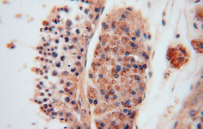 Immunohistochemical of paraffin-embedded human testis using Catalog No:107963(ALDH1B1 antibody) at dilution of 1:100 (under 40x lens)