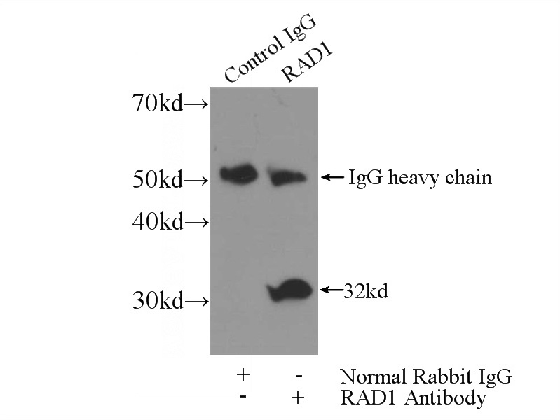 IP Result of anti-RAD1 (IP:Catalog No:114509, 3ug; Detection:Catalog No:114509 1:300) with HeLa cells lysate 3200ug.
