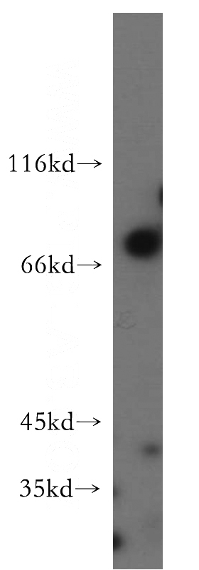HeLa cells were subjected to SDS PAGE followed by western blot with Catalog No:110179(EIF2AK1 antibody) at dilution of 1:500