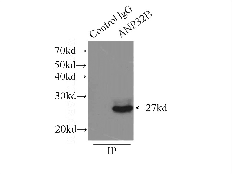 IP Result of anti-ANP32B (IP:Catalog No:108105, 3ug; Detection:Catalog No:108105 1:1000) with HeLa cells lysate 3000ug.