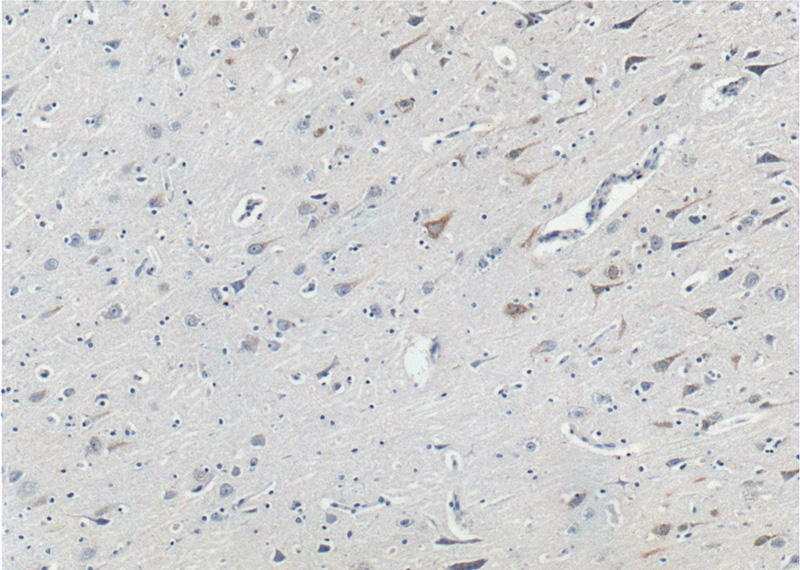 Immunohistochemistry of paraffin-embedded human brain tissue slide using Catalog No:113127(NFASC Antibody) at dilution of 1:200 (under 10x lens).