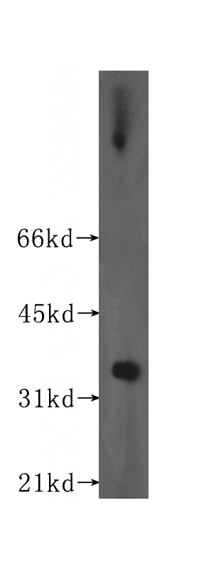 human testis tissue were subjected to SDS PAGE followed by western blot with Catalog No:111551(HSD17B8 antibody) at dilution of 1:500