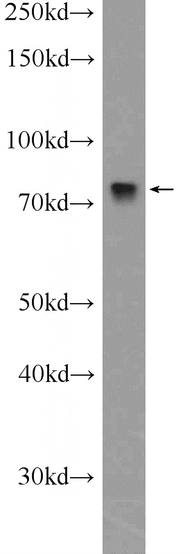 Jurkat cells were subjected to SDS PAGE followed by western blot with Catalog No:109848(DEF6 Antibody) at dilution of 1:600