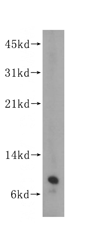 HEK-293 cells were subjected to SDS PAGE followed by western blot with Catalog No:115089(SEC61G antibody) at dilution of 1:400