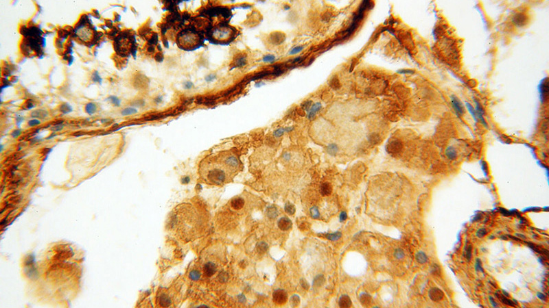 Immunohistochemical of paraffin-embedded human testis using Catalog No:109736(CTTNBP2 antibody) at dilution of 1:100 (under 40x lens)