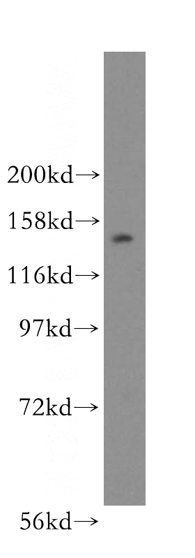 HeLa cells were subjected to SDS PAGE followed by western blot with Catalog No:113376(NUP160 antibody) at dilution of 1:500