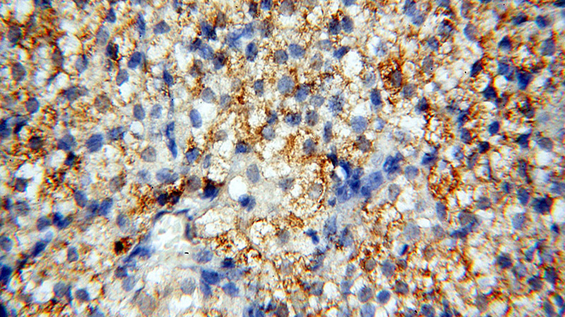 Immunohistochemical of paraffin-embedded human ovary using Catalog No:111120(GPR177 antibody) at dilution of 1:100 (under 40x lens)