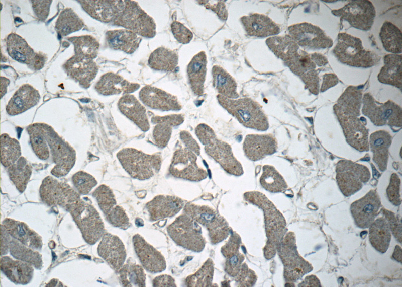 Immunohistochemistry of paraffin-embedded human heart tissue slide using Catalog No:107795(ADM2 Antibody) at dilution of 1:50 under 40x lens