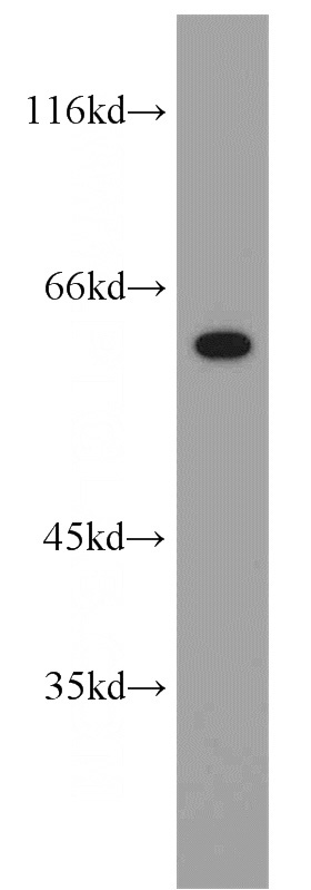 K-562 cells were subjected to SDS PAGE followed by western blot with Catalog No:113305(NOP58 antibody) at dilution of 1:1000
