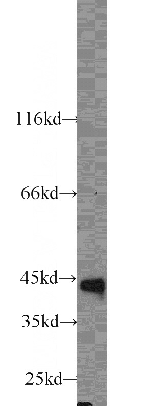 Raji cells were subjected to SDS PAGE followed by western blot with Catalog No:109138(CD79A antibody) at dilution of 1:1000