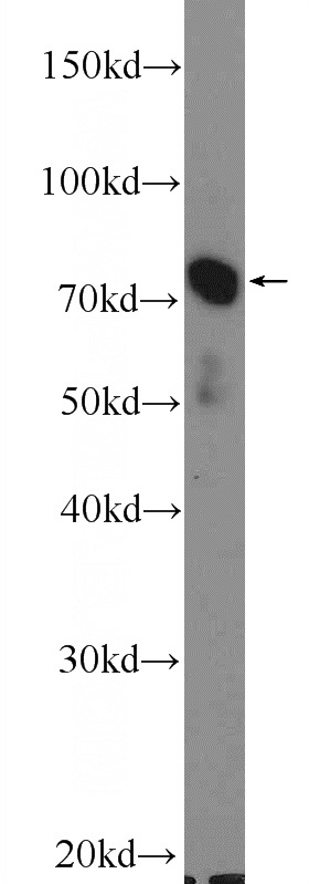 mouse testis tissue were subjected to SDS PAGE followed by western blot with Catalog No:110208(EFHC1 Antibody) at dilution of 1:600