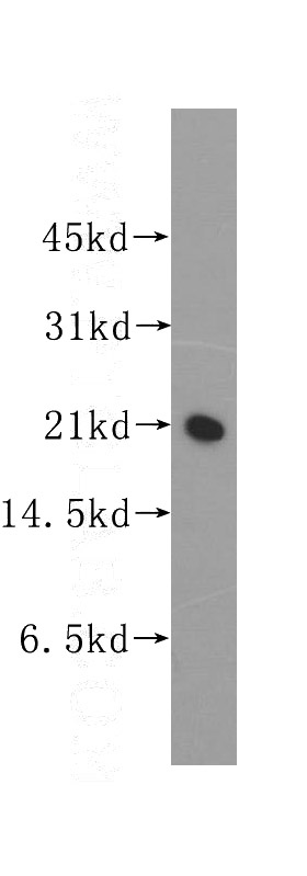 BxPC-3 cells were subjected to SDS PAGE followed by western blot with Catalog No:114682(REEP6 antibody) at dilution of 1:400
