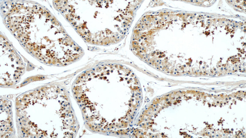 Immunohistochemical of paraffin-embedded human testis using Catalog No:109408(CLTCL1 antibody) at dilution of 1:50 (under 10x lens)