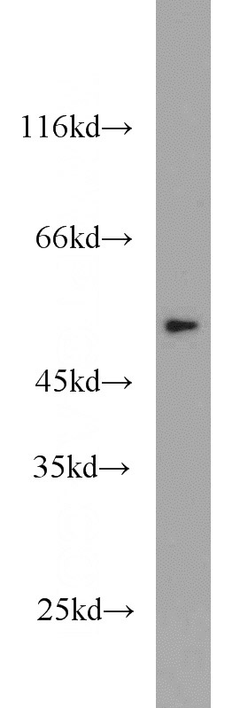 A431 cells were subjected to SDS PAGE followed by western blot with Catalog No:116052(THRA antibody) at dilution of 1:2000