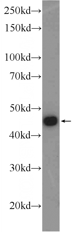 COLO 320 cells were subjected to SDS PAGE followed by western blot with Catalog No:111982(KIAA0494 Antibody) at dilution of 1:600