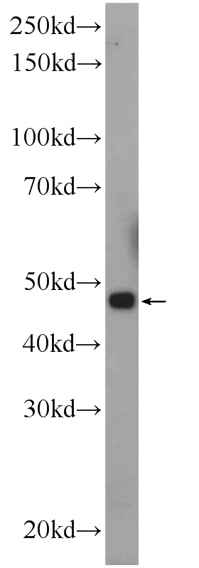 rat kidney tissue were subjected to SDS PAGE followed by western blot with Catalog No:109204(CGRRF1 Antibody) at dilution of 1:600