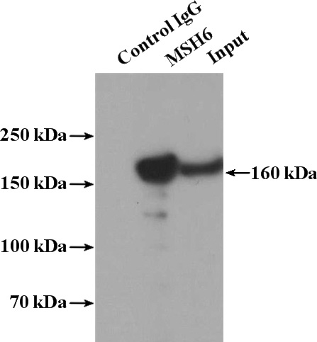 IP Result of anti-MSH6 (IP:Catalog No:112869, 4ug; Detection:Catalog No:112869 1:600) with HEK-293 cells lysate 1120ug.