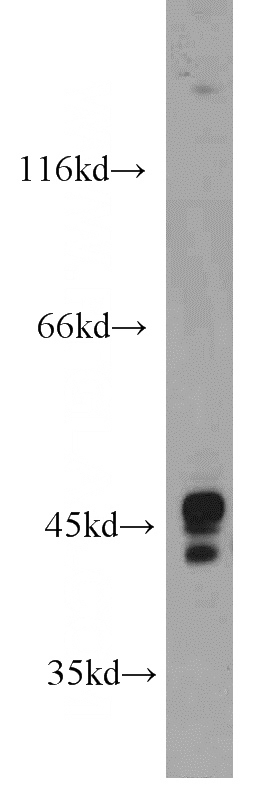 HeLa cells were subjected to SDS PAGE followed by western blot with Catalog No:113330(OFD1 antibody) at dilution of 1:500