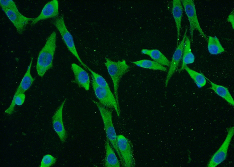 Immunofluorescent analysis of A375 cells using Catalog No:111679(IGF2BP1 Antibody) at dilution of 1:50 and Alexa Fluor 488-congugated AffiniPure Goat Anti-Rabbit IgG(H+L)