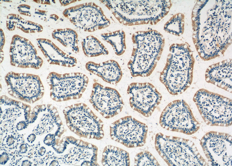 Immunohistochemistry of paraffin-embedded human small intestine tissue slide using Catalog No:111711(HTR3A Antibody) at dilution of 1:50 (under 10x lens)