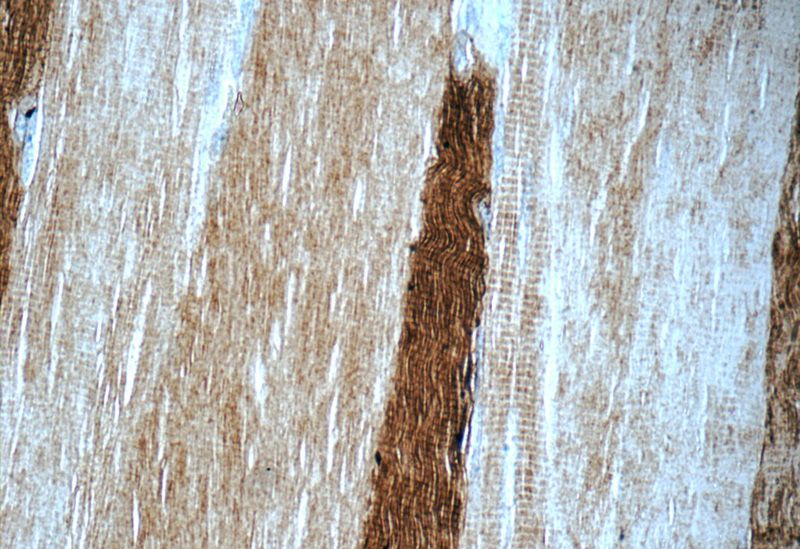 Immunohistochemistry of paraffin-embedded human skeletal muscle tissue slide using Catalog No:112928(MYH1 Antibody) at dilution of 1:50 (under 40x lens)