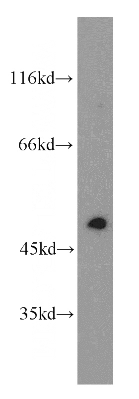 mouse brain tissue were subjected to SDS PAGE followed by western blot with Catalog No:110221(EGR2 antibody) at dilution of 1:1000