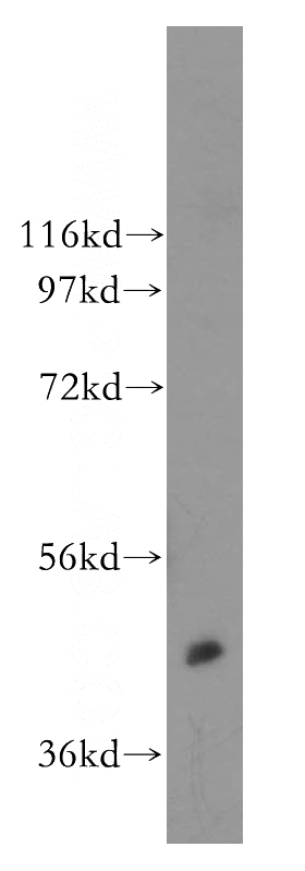 HEK-293 cells were subjected to SDS PAGE followed by western blot with Catalog No:108913(CAMK2A antibody) at dilution of 1:400