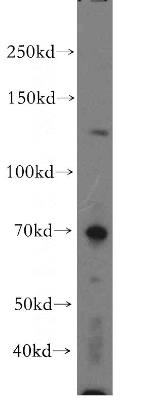 PC-3 cells were subjected to SDS PAGE followed by western blot with Catalog No:110548(FBXO18 antibody) at dilution of 1:500