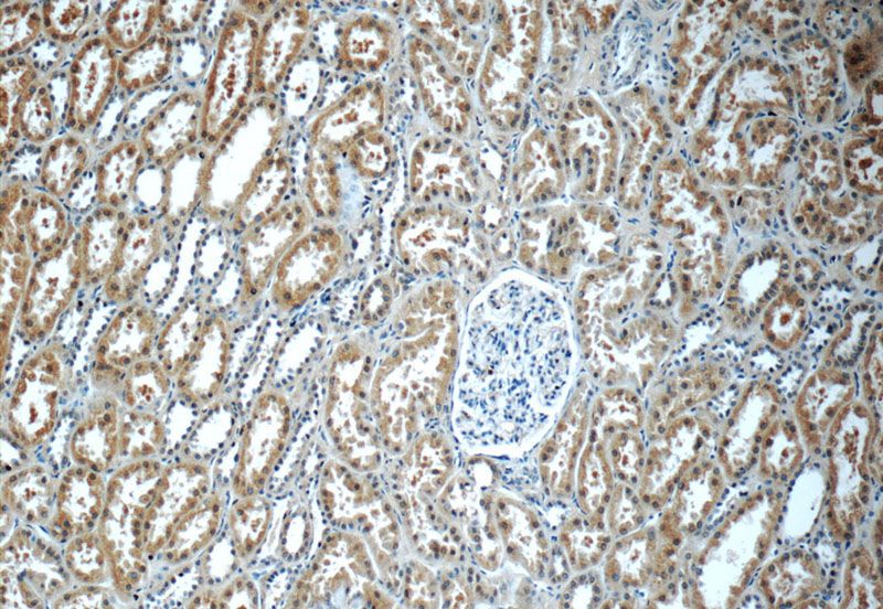 Immunohistochemistry of paraffin-embedded human kidney tissue slide using Catalog No:116417(TRPV4 Antibody) at dilution of 1:50 (under 10x lens)