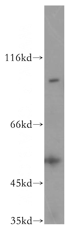 HeLa cells were subjected to SDS PAGE followed by western blot with Catalog No:116071(TLK1 antibody) at dilution of 1:500