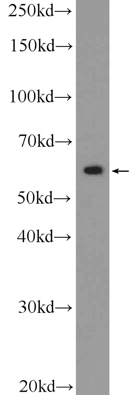 mouse brain tissue were subjected to SDS PAGE followed by western blot with Catalog No:116911(ZBTB22 Antibody) at dilution of 1:600
