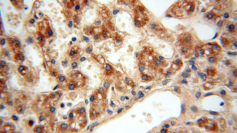 Immunohistochemical of paraffin-embedded human liver using Catalog No:108353(ATP5F1 antibody) at dilution of 1:100 (under 40x lens)