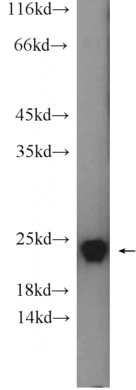 mouse brain tissue were subjected to SDS PAGE followed by western blot with Catalog No:114423(RAB24 Antibody) at dilution of 1:300