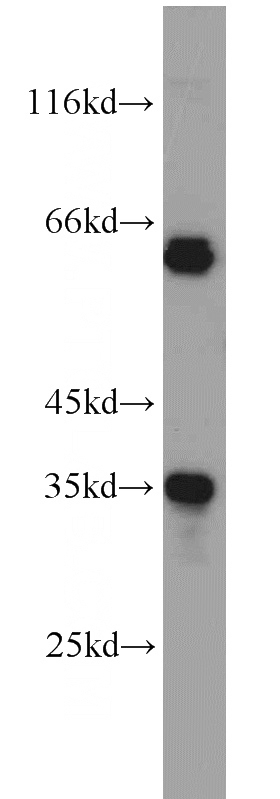 HeLa cells were subjected to SDS PAGE followed by western blot with Catalog No:110198(EIF3J antibody) at dilution of 1:500