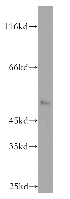 A431 cells were subjected to SDS PAGE followed by western blot with Catalog No:113591(PARP15 antibody) at dilution of 1:400