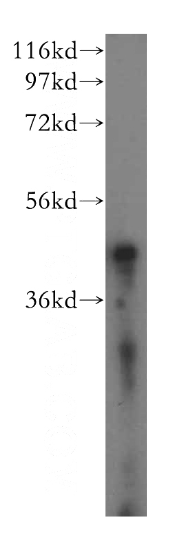 human skeletal muscle tissue were subjected to SDS PAGE followed by western blot with Catalog No:107727(ACAT1 antibody) at dilution of 1:500