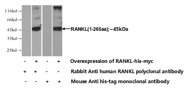 Transfected HEK-293 cells were subjected to SDS PAGE followed by western blot with Catalog No:114544(RANKL Antibody) at dilution of 1:700
