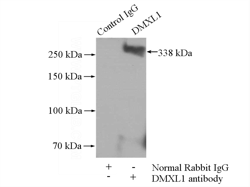 IP Result of anti-DMXL1 (IP:Catalog No:110075, 4ug; Detection:Catalog No:110075 1:300) with HEK-293 cells lysate 1480ug.