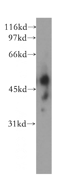 human serum tissue were subjected to SDS PAGE followed by western blot with Catalog No:115225(SIGLEC6 antibody) at dilution of 1:300