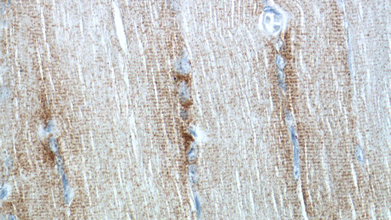Immunohistochemistry of paraffin-embedded human skeletal muscle tissue slide using Catalog No:109331(CKMT2 Antibody) at dilution of 1:50 (under 40x lens)