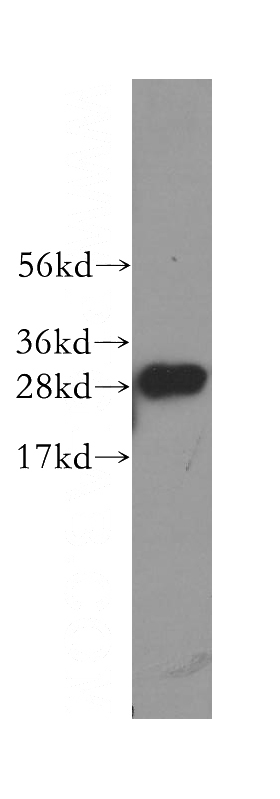 human spleen tissue were subjected to SDS PAGE followed by western blot with Catalog No:108685(C1QA antibody) at dilution of 1:500